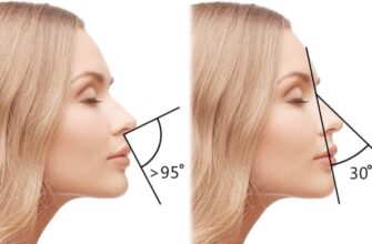 Як підготуватися до пластичної операції: поради для впевненого та безпечного рішення